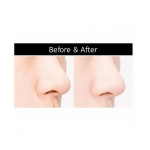 3-ступенчатый патч для очищения пор носа Missha Super Aqua Mini Pore 3 Step Nose Patch (Фото #2)